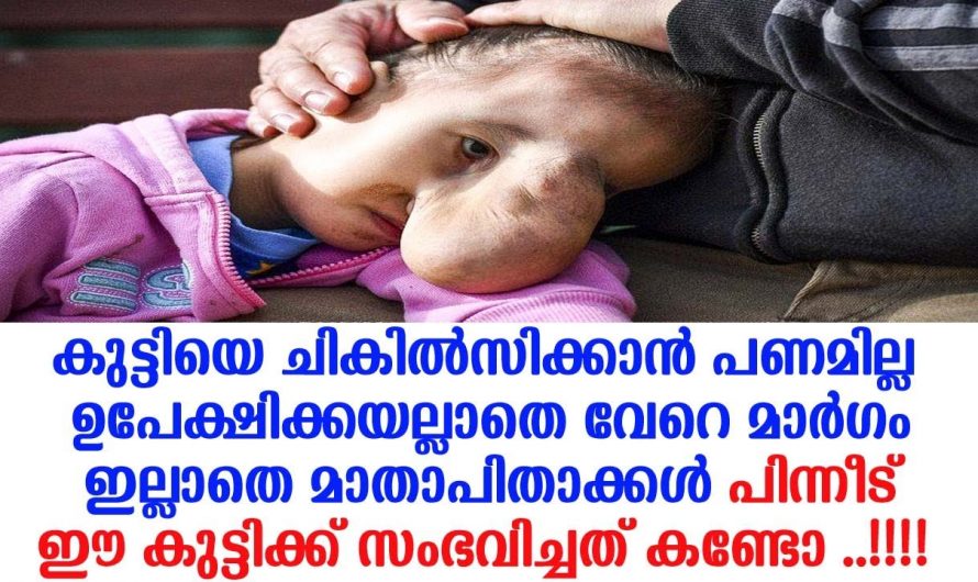 ചികിത്സിക്കാൻ പണമില്ല കുട്ടിയെ ഉപേക്ഷിക്കുകയല്ലാതെ വേറെ മാർഗ്ഗവുമില്ല. എന്നാൽ കുട്ടിയുടെ അവസ്ഥയിൽ പിന്നീട് സംഭവിച്ചത് കണ്ടോ.