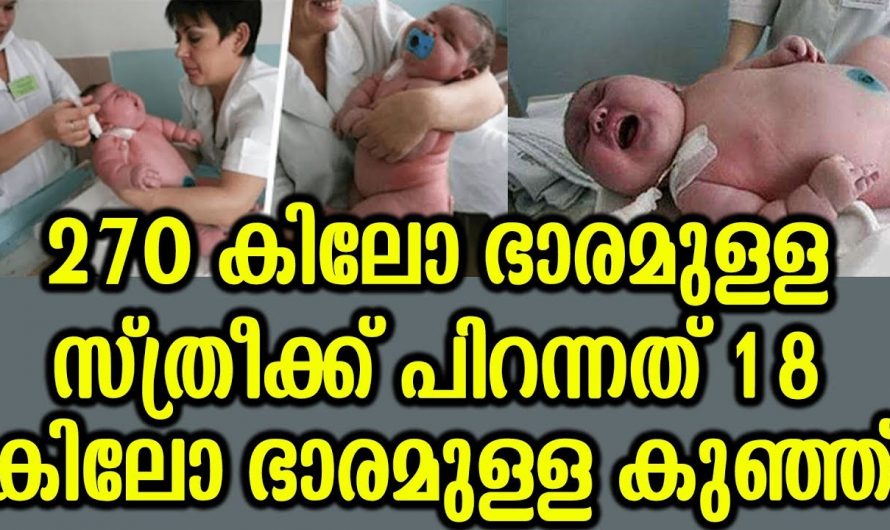 ലോകത്തിലെ ഏറ്റവും ഭാരമുള്ള കുട്ടി. 270 ഭാരമുള്ള അമ്മയ്ക്ക് ജനിച്ചത് 18 കിലോ ഭാരമുള്ള കുട്ടി.