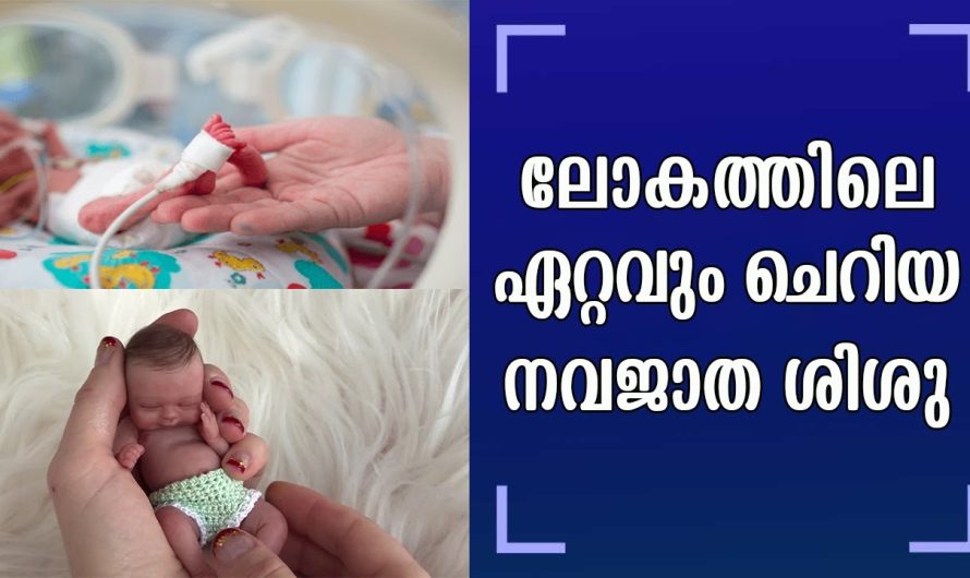 ലോകത്തിലെ ഏറ്റവും ചെറിയ കുഞ്ഞിനെ നിങ്ങൾ കണ്ടിട്ടുണ്ടോ അഞ്ചുമാസത്തിൽ പ്രസവിച്ച കുഞ്ഞിന്റെ ഇപ്പോഴത്തെ അവസ്ഥ ഇതാ.