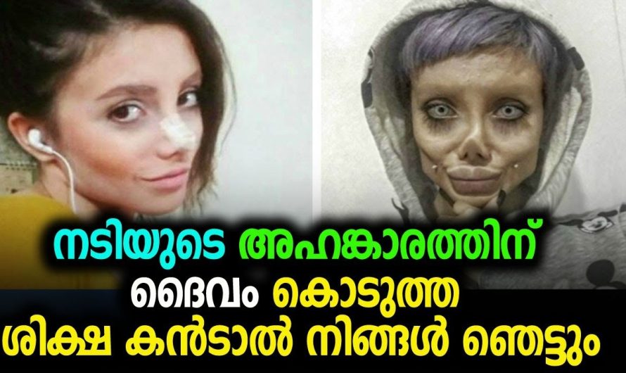 സിനിമാനടിയെ പോലെ ആകണമെന്ന് കരുതി പോസ്റ്റ്മോർട്ടം ചെയ്ത് ഭീകരമുഖമായ പെൺകുട്ടിയെ കണ്ടോ.